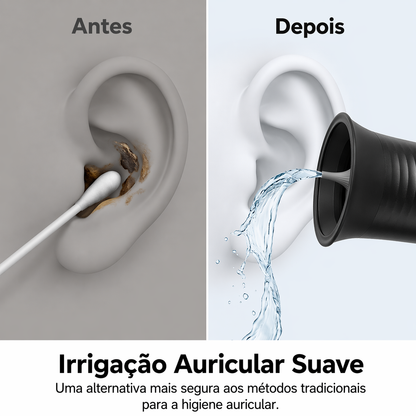 Kit de Limpeza de Ouvidos Elétrico Recarregável
